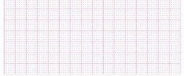 EKG-P., Hellige MicroSmart/ Mac 500, 360 Blatt (90 mm x 90 mm) – Diagramm Halbach