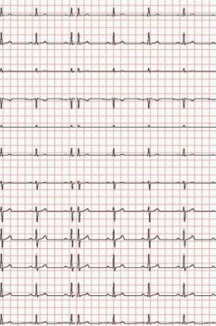 EKG-Papier zu Econet Medical, Cardio-M-Plus (210 mm x 30 m) – Diagramm Halbach