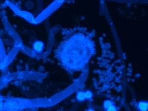 Fluoreszenz-Binokularmikroskop medicus pro Myko – Helmut Hund