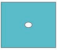 Barrier Lochtuch (50 x 60cm) (2x70 Stück) – Mölnlycke Health Care