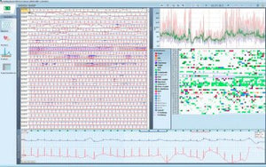 Schiller Darwin EKG-Arrhythmie-Analyse für Domino ( light) – SOMNOmedics