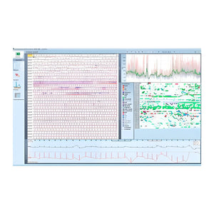 Schiller Darwin EKG-Arrhythmie-Analyse für Domino ( light) – SOMNOmedics