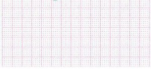 GE-EKG-Papier, Mac 400 280 Blatt (80 x 90 mm) – Diagramm Halbach
