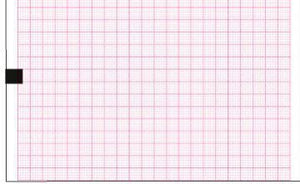 EKG-P., Dimeq EKG 503 V Rolle (120 mm x 30 m) – Diagramm Halbach