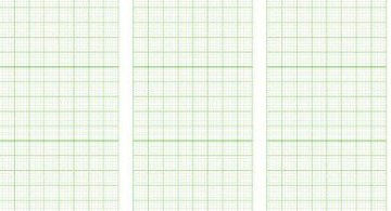 EKG-P., Dimeq EKG-503 A/E Rolle (145 mm x 30 m) – Diagramm Halbach
