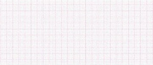 EKG-P., Hell. EK 53/56 Dim.603 370 Blatt (130 mm x 135 mm) (10 Stück) – Diagramm Halbach