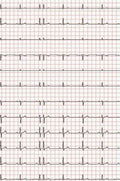EKG-Papier zu Econet Medical, Cardio-M-Plus (210 mm x 30 m) – Diagramm Halbach