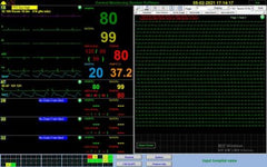Monitore