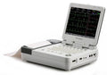 Edan SE-12 Express 12-Kanal EKG Gerät Mit Ergometriepaket – EDAN Instruments