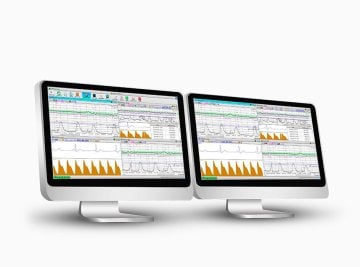 Fetalmonitoring CTG