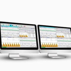 Fetalmonitoring CTG