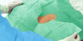 Hartmann Foliodrape® Protect Lochtücher selbstklebend – Paul Hartmann
