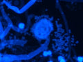 Fluoreszenz-Binokularmikroskop medicus pro Myko – Helmut Hund
