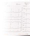 Thermopapier Gefaltet Für EKG-9022G / EKG-1250G / 2250 / 3250 – Nihon Kohden