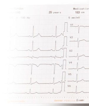 Thermopapier Gefaltet Für EKG-9022G / EKG-1250G / 2250 / 3250 – Nihon Kohden