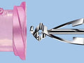 B. Braun Sicherheits-Venenverweilkanüle Introcan Safety®-W – B. Braun