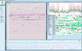 Schiller Darwin EKG-Arrhythmie-Analyse für Domino ( light) – SOMNOmedics
