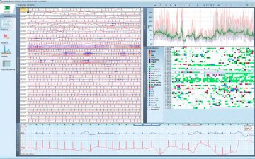 Schiller Darwin EKG-Arrhythmie-Analyse für Domino ( light) – SOMNOmedics