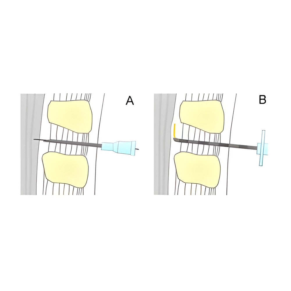 BD Yale Spinal-und Lumbalpunktionskanüle – Becton Dickinson
