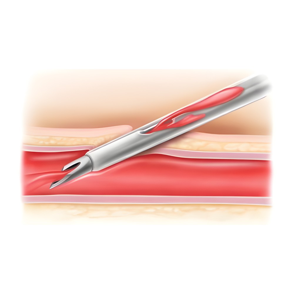 Becton Dickinson Insyte™ Autoguard™ Sicherheitsvenenverweilkatheter mit Flügeln – Becton Dickinson