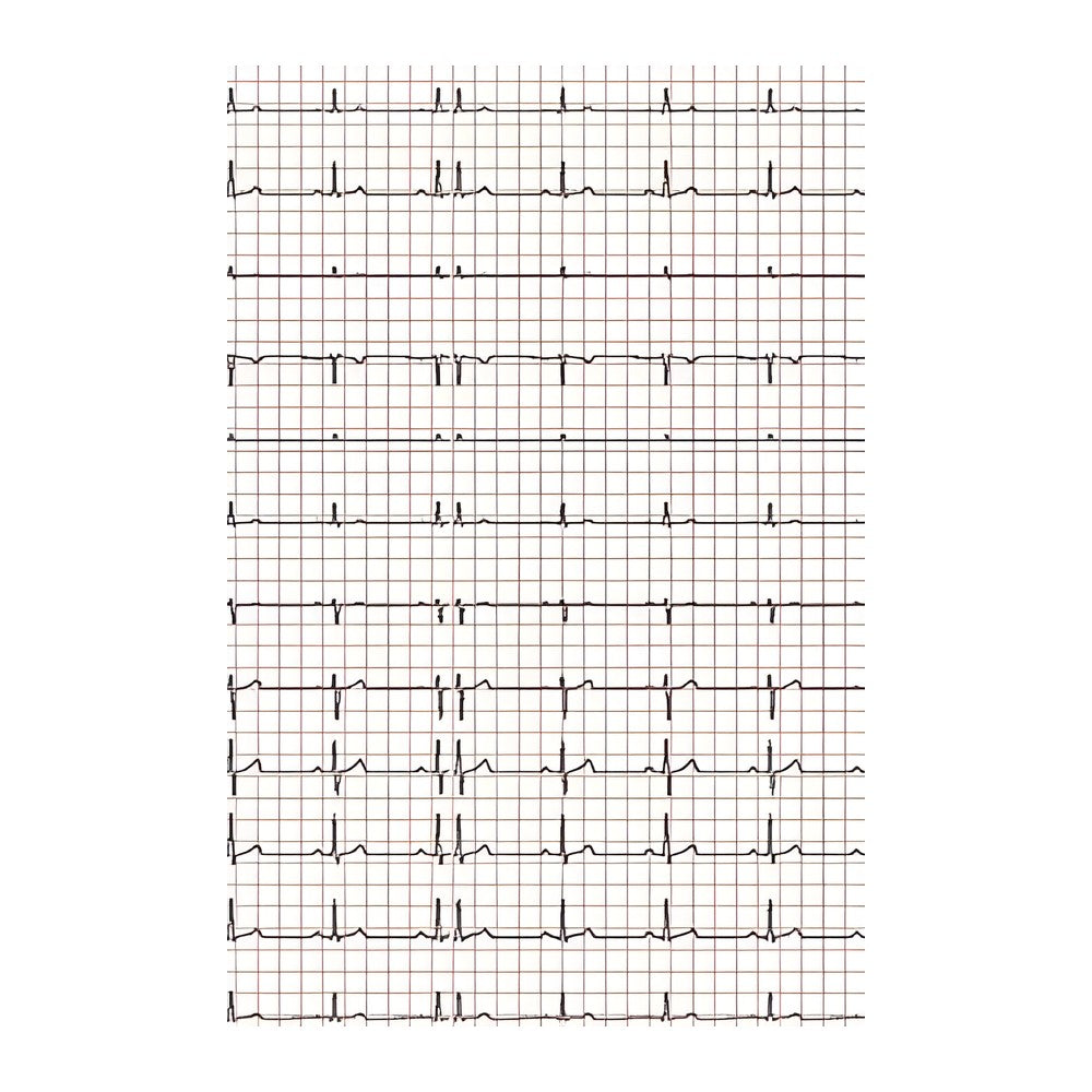 EKG-Papier zu Econet Medical, Cardio-M-Plus (210 mm x 30 m) – Diagramm Halbach