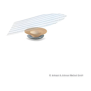 Ethicon ULTRAPRO® Plug Stecker für Hernien – Ethicon