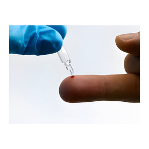 Quo Test Testset HbA1c, 15 Kartuschen 0031 – EKF-diagnostic