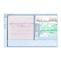 Schiller Darwin EKG-Arrhythmie-Analyse für Domino ( light) – SOMNOmedics