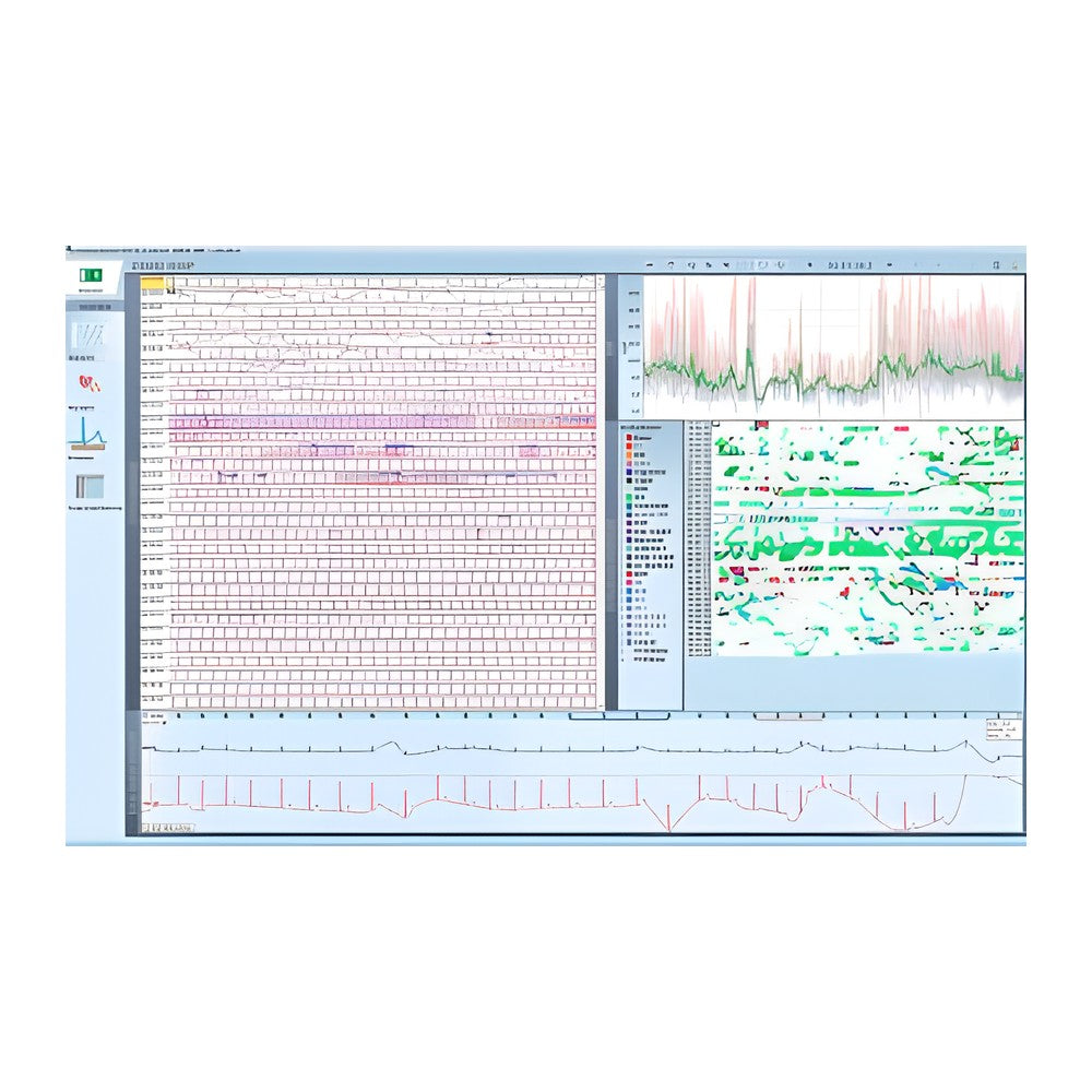 Schiller Darwin EKG-Arrhythmie-Analyse für Domino ( light) – SOMNOmedics